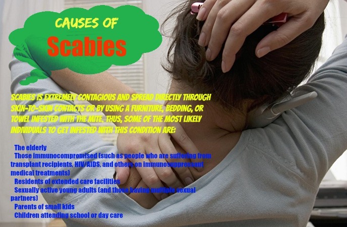 home-remedies-for-scabies-causes-of-scabies