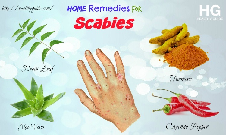 14 Home Remedies for Scabies on Skin & Scalp in Children & Adults