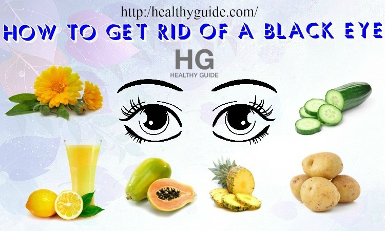 28 Tips How to Get Rid of a Black Eye and Swelling Fast Overnight