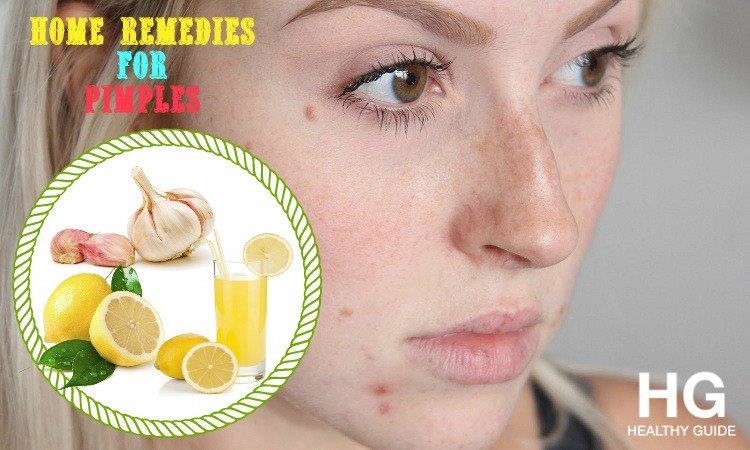 53 Best Natural Home Remedies for Pimples on Chin, Face, Nose, & Back