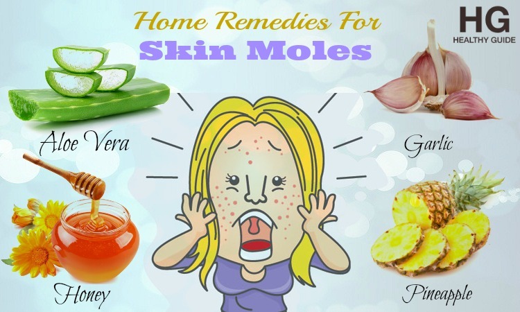 20 Home Remedies For Skin Moles Removal On Skin And Face
