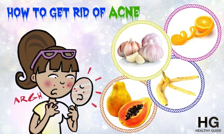 40 Tips How to Get Rid of Acne and Pimples Breakouts Fast and Naturally