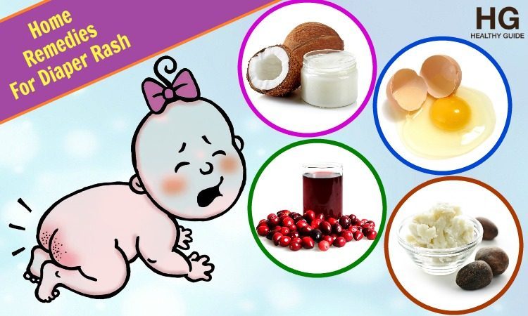 top-24-home-remedies-for-diaper-rash-pain-in-babies