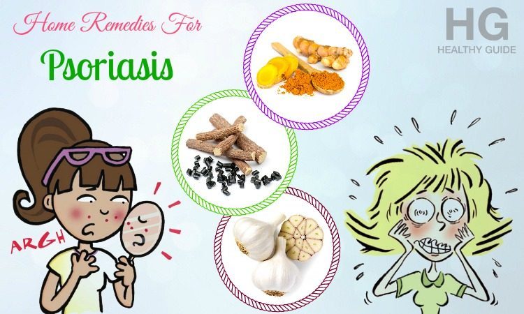home remedies for psoriasis on my scalp