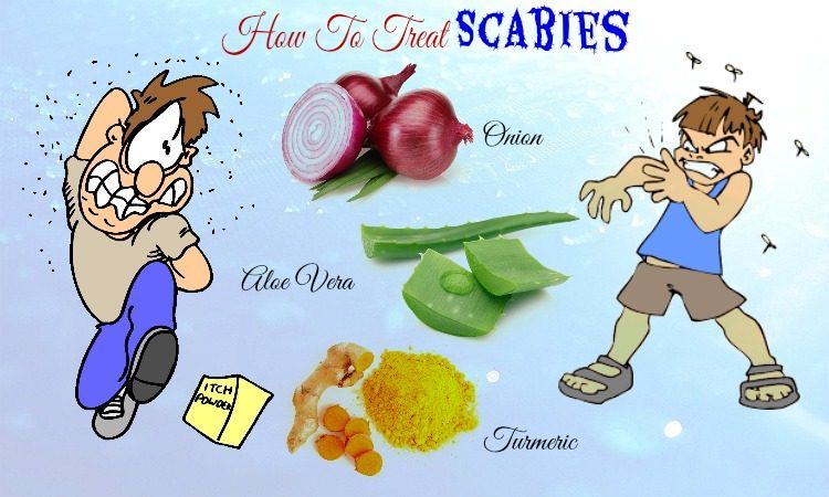 Scabies Treatment Natural