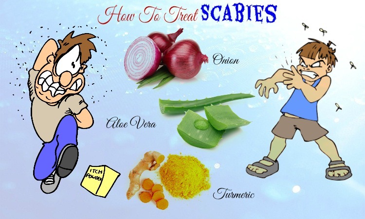 32 Tips How to Treat Scabies on Face and Scalp Naturally at Home