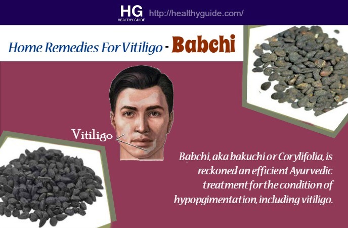 Home Remedies For Vitiligo 