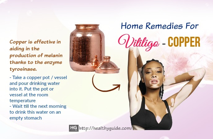 Home Remedies For Vitiligo