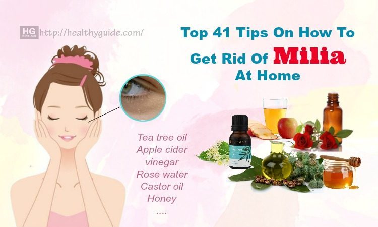 41-tips-how-to-get-rid-of-milia-on-lips-forehead-around-eyes-fast