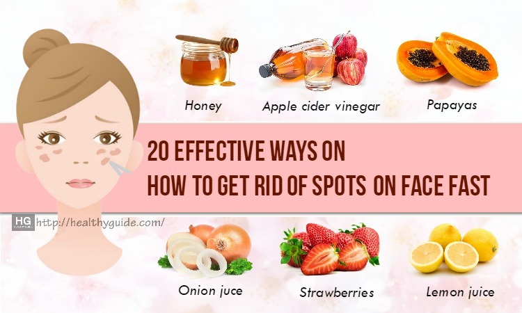 20 Tips How to Get Rid of Spots on Face, Back, Legs & Chest