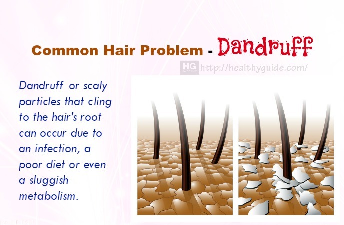 Common Hair Problem 