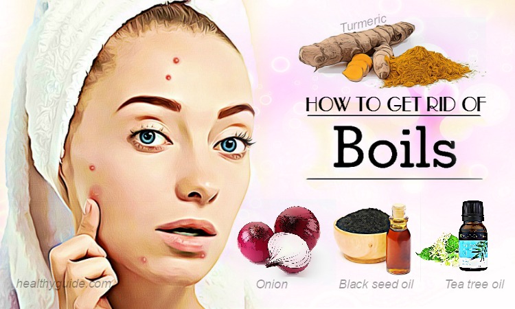 21 Tips How to Get Rid of Boils on Face, Inner Thighs, Nose, & Butt