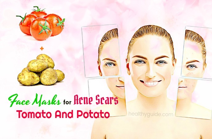 face masks for acne scars 