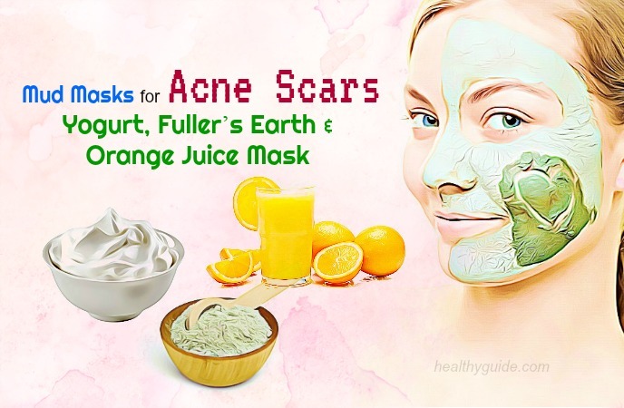 mud masks for acne 