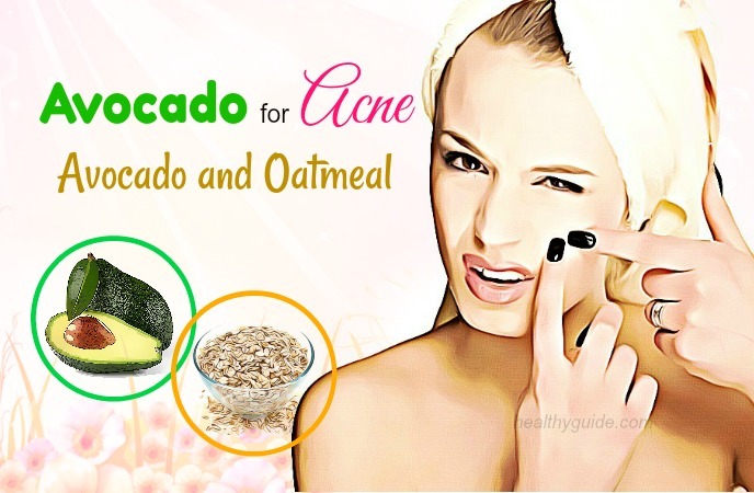 avocado for acne