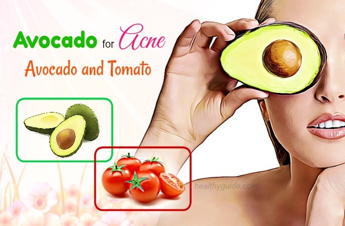 avocado for acne