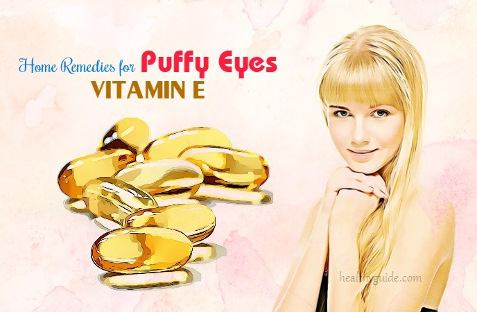 home remedies for puffy eyes