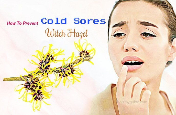 how to prevent cold sores