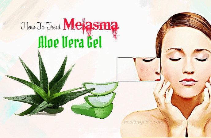 how to treat melasma 