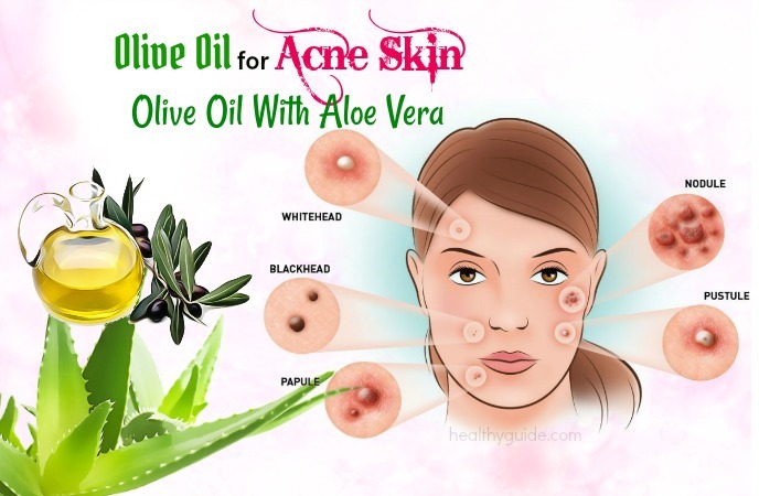 olive oil for acne 