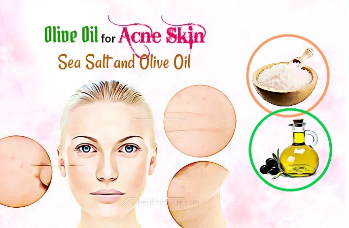 olive oil for acne