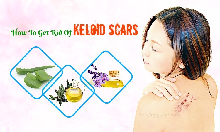 13 Tips How to Get Rid of Keloid Scars on Ear, Nose, Chest, Neck, & Back