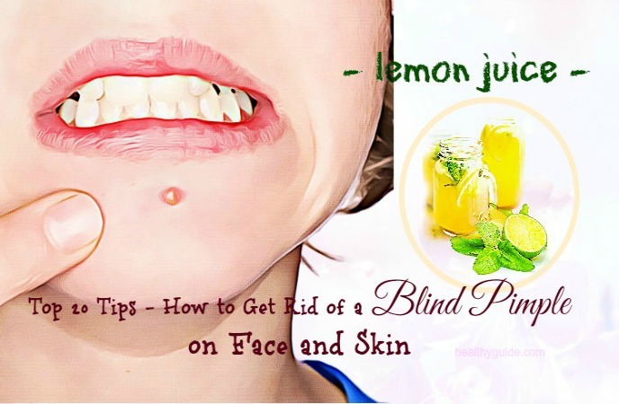 how to get rid of a blind pimple