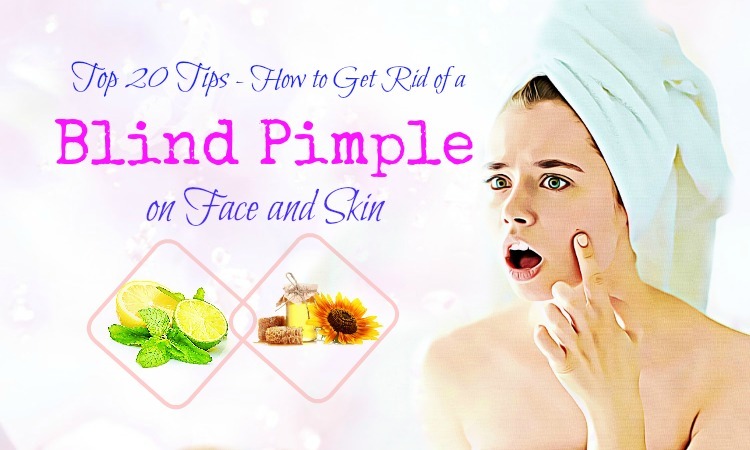 20 Tips How to Get Rid of a Blind Pimple on Chin, Ear, Nose, & Forehead