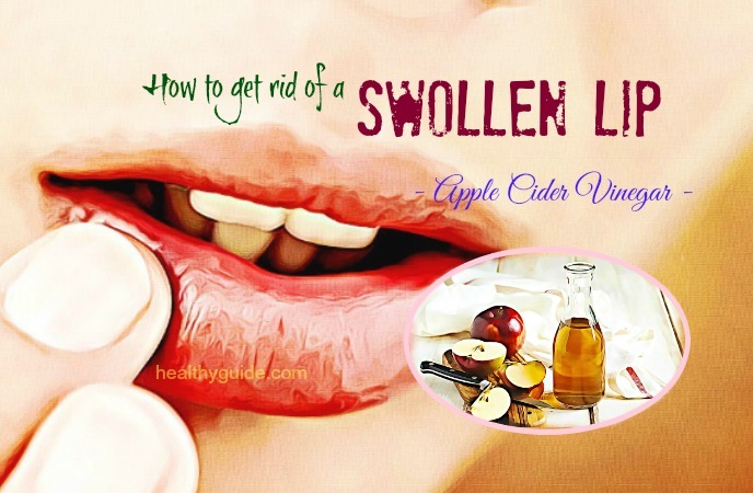 how to get rid of a swollen lip 