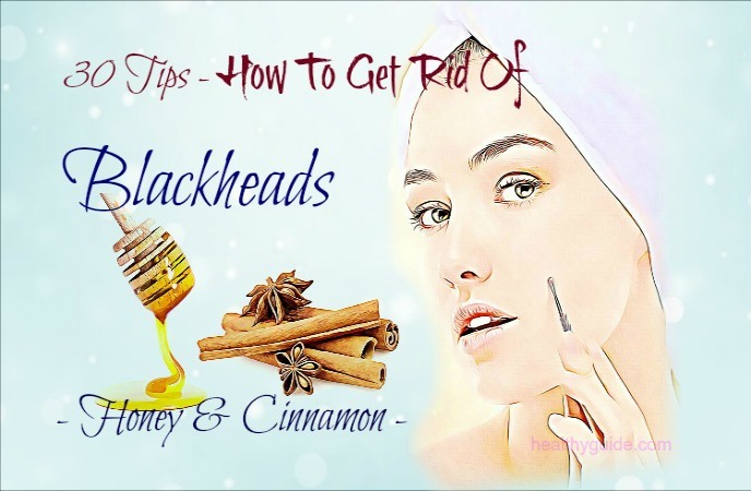 how to get rid of blackheads 