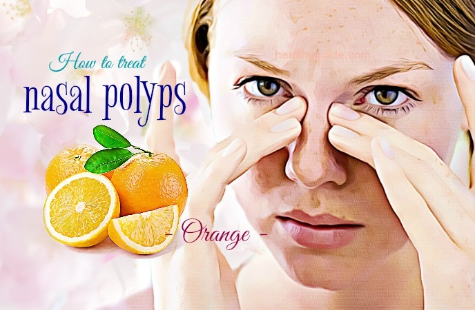 how to treat nasal polyps 