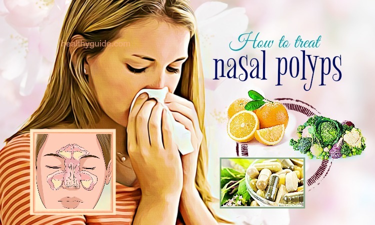 31 Tips How to Treat Nasal Polyps in Children & Adults without Surgery
