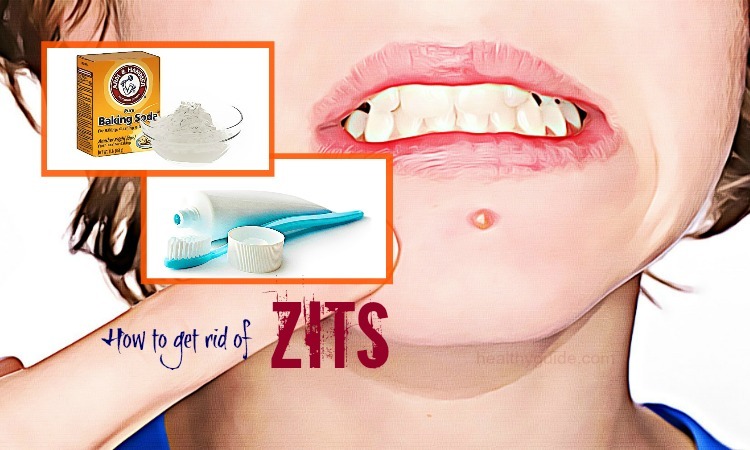 37 Tips How to Get Rid of Zits on Nose, Lips, Chest, & Scalp Overnight