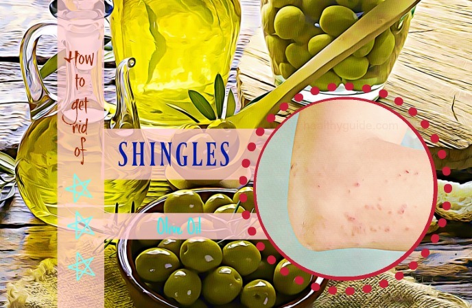 how to get rid of shingles