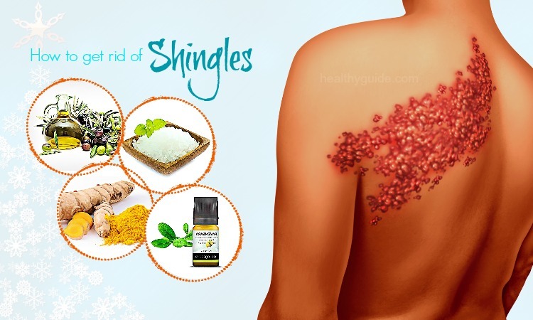 how do you treat shingles rash