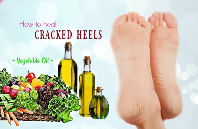 how to heal cracked heels
