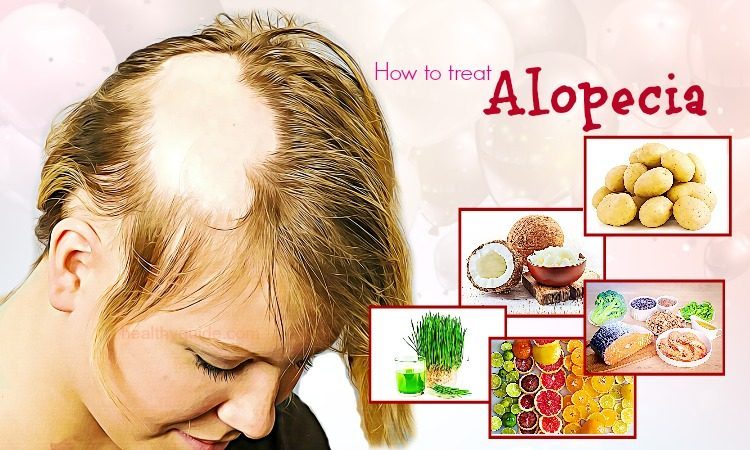 41 Tips How To Treat Alopecia Fast And Naturally In Men And Women 