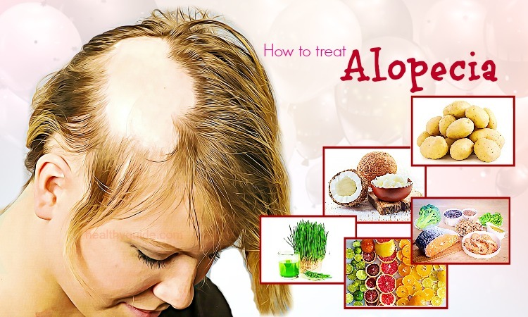 41 Tips How to Treat Alopecia Fast & Naturally in Men and Women