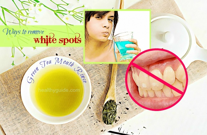 ways to remove white spots