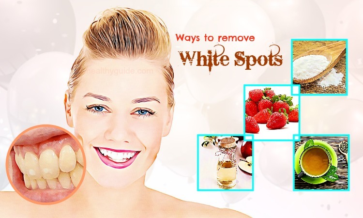 34 Best Ways to Remove White Spots from Teeth Fast & Naturally