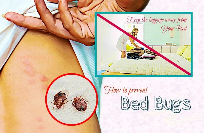 how to prevent bed bugs