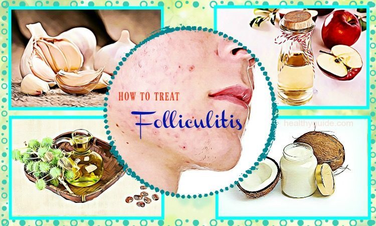 30 Tips How To Treat Folliculitis On Face And Scalp 9621