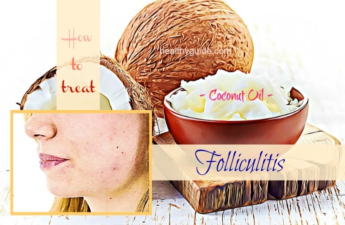 how to treat folliculitis