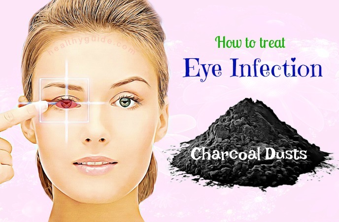 how to treat eye infection