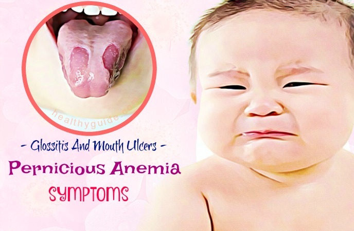 pernicious anemia symptoms