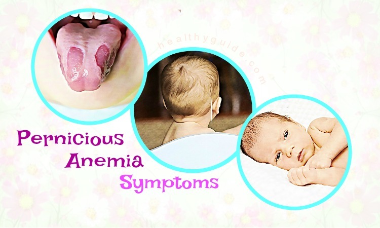 22 Pernicious Anemia Symptoms in Infants & Adults and Treatments