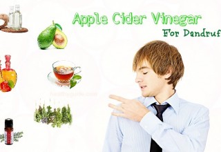 30 Ways to Use Apple Cider Vinegar for Dandruff And Itchy Scalp, Hair Loss