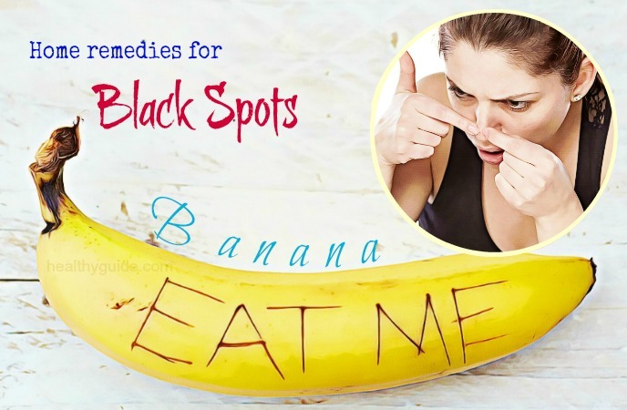 home remedies for black spots