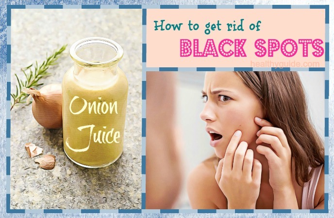 how to get rid of black spots