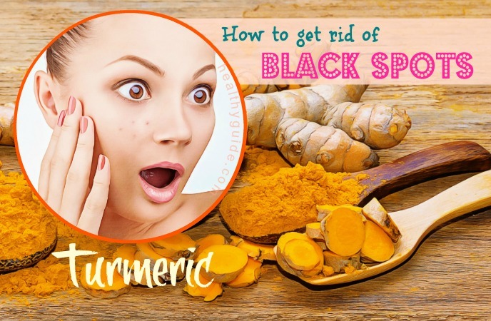 how to get rid of black spots